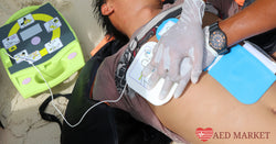 Can Anyone Buy an AED?